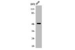 Western Blot analysis of A549 cells using Arrestin-