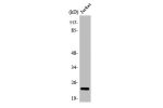Western Blot analysis of Jurkat cells using Asf1a Polyclonal Antibody