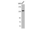 Western Blot analysis of 293 cells using Ataxin-2 Polyclonal Antibody