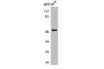 Western Blot analysis of HeLa cells using ATF-2 Polyclonal Antibody