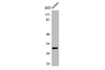 Western Blot analysis of Jurkat cells using ATF-5 Polyclonal Antibody
