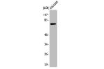 Western Blot analysis of COLO205 cells using ATF-6