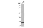 Western Blot analysis of Jurkat cells using ATP5H Polyclonal Antibody