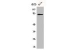 Western Blot analysis of 293 cells using BACH1 Polyclonal Antibody