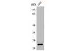 Western Blot analysis of COS7 cells using Bad Polyclonal Antibody