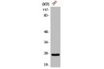 Western Blot analysis of 293 cells using Bak Polyclonal Antibody