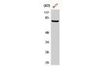Western Blot analysis of HeLa cells using BARD1 Polyclonal Antibody