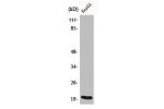 Western Blot analysis of HepG2 cells using Bax Polyclonal Antibody