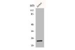 Western Blot analysis of Jurkat cells using BCA3 Polyclonal Antibody