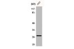 Western Blot analysis of COS7 cells using Bcl-2 Polyclonal Antibody