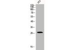 Western Blot analysis of 3T3 cells using Bcl-2 Polyclonal Antibody