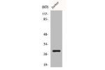 Western Blot analysis of Jurkat cells using Bcl-2 Polyclonal Antibody