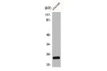 Western Blot analysis of COLO205 cells using Bcl-w Polyclonal Antibody