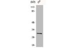 Western Blot analysis of 293 cells using Bcl-x Polyclonal Antibody