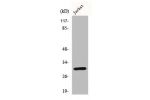Western Blot analysis of Jurkat cells using Bcl-x Polyclonal Antibody