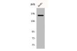 Western Blot analysis of HuvEc cells using Bcr Polyclonal Antibody
