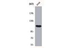 Western Blot analysis of A549 cells using Bek Polyclonal Antibody