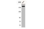 Western Blot analysis of A549 cells using BIG2 Polyclonal Antibody