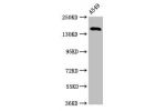 Western Blot<br />
Positive WB detected in:A549 whole cell lysate<br />
All lanes:A2ML1 antibody at 3.2