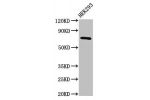 Western Blot<br />
Positive WB detected in:HEK293 whole cell lysate<br />
All lanes:AACS antibody at 2.5