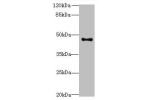 Western blot<br />
All lanes: AADACL2 antibody at 2ug/ml+PC-3 whole cell lysate<br />
Secondary<br />
Goat polyclonal to rabbit at 1/10000 dilution<br />
Predicted band size: 47,6 kDa<br />
Observed band size: 46 kDa<br />