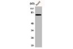 Western Blot analysis of HepG2 cells using Bmx Polyclonal Antibody