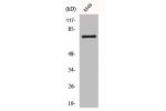 Western Blot analysis of A549 cells using Bmx Polyclonal Antibody