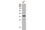 Western Blot analysis of K562 cells using BNIP-2 Polyclonal Antibody
