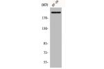 Western Blot analysis of HT29 cells using BRCA1 Polyclonal Antibody