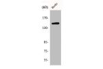 Western Blot analysis of HepG2 cells using BRCAA1 Polyclonal Antibody