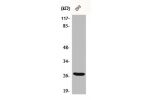 Western Blot analysis of 293 cells using BRMS-1 Polyclonal Antibody