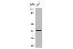 Western Blot analysis of Jurkat cells using BST-1 Polyclonal Antibody