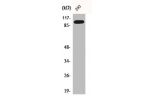 Western Blot analysis of A549 cells using BTF Polyclonal Antibody