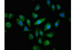 Immunofluorescent analysis of A549 cells using CSB-PA001062LA01HU at a dilution of 1:100 and Alexa Fluor 488-congugated AffiniPure Goat Anti-Rabbit IgG(H+L)
