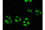 Immunofluorescent analysis of HepG2 cells using CSB-PA001063LA01HU at a dilution of 1:100 and Alexa Fluor 488-congugated AffiniPure Goat Anti-Rabbit IgG(H+L)