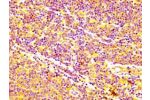 IHC image of CSB-PA001064LA01HU diluted at 1:400 and staining in paraffin-embedded human lymph node tissue performed on a Leica BondTM system. After dewaxing and hydration, antigen retrieval was mediated by high pressure in a citrate buffer (pH 6.0). Sect