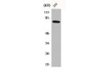 Western Blot analysis of 293 cells using Btk Polyclonal Antibody