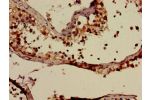 Immunohistochemistry of paraffin-embedded human testis tissue using CSB-PA001067LA01HU at dilution of 1:100