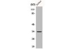 Western Blot analysis of Jurkat cells using C/EBP e Polyclonal Antibody