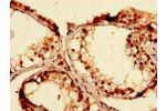 Immunohistochemistry of paraffin-embedded human testis tissue using CSB-PA001080LA01HU at dilution of 1:100