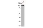 Western Blot analysis of COLO205 cells using C/EBP ? Polyclonal Antibody