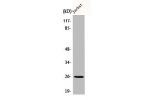 Western Blot analysis of Jurkat cells using C1q-B Polyclonal Antibody
