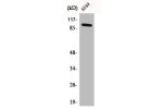 Western Blot analysis of HuvEc cells using C6 Polyclonal Antibody