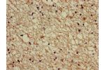 Immunohistochemistry of paraffin-embedded human brain tissue using CSB-PA001102LA01HU at dilution of 1:100