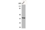 Western Blot analysis of LOVO cells using CA VI Polyclonal Antibody