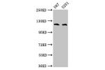 Western Blot<br />
Positive WB detected in:U87 whole cell lysate,U251 whole cell lysate<br />
All lanes:ABL2 antibody at 4