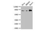 Western Blot<br />
Positive WB detected in:Hela whole cell lysate,HEK293 whole cell lysate,Mouse heart tissue<br />
All lanes: ABLIM1 antibody at 3.4ug/ml<br />
Secondary<br />
Goat polyclonal to rabbit IgG at 1/50000 dilution<br />
Predicted band size: 8