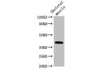 Western Blot<br />
Positive WB detected in:Mouse skeletal muscle tissue<br />
All lanes:ABO antibody at 3.5