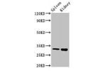 Western Blot<br />
Positive WB detected in:Mouse spleen tissue,Mouse kidney tissue<br />
All lanes:ABT1 antibody at 3