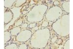 Immunohistochemistry of paraffin-embedded human thyroid tissue<br />
 gland using CSB-PA001117LA01HU at dilution 1:100